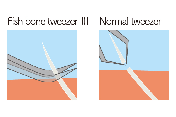features-of-fish-bone-tweezer